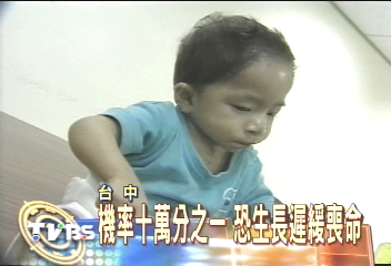 罕見!4歲男童僅5公斤 智商2歲