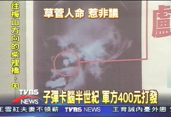 子彈卡腦半世紀 軍方400元打發