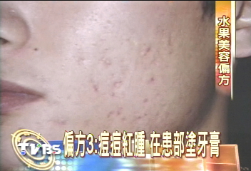蔬果有新妙用　美容秘方大公開