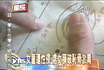 〈獨家〉慘！2歲女童　疑遭保母男友性侵