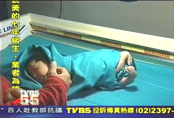 祕魯龍蝦寶寶　罹患罕見畸形症