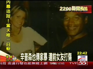 辛普森也傳家暴 遭前女友打傷
