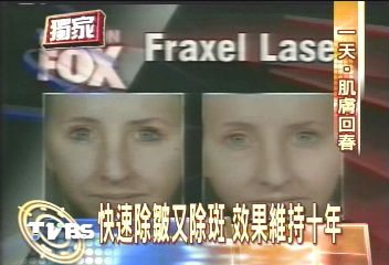 〈獨家〉美白除皺新科技 一天復原效果十年