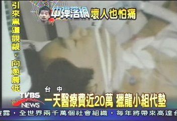 張錫銘粉碎性骨折 下半身不會癱瘓