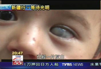 【重建光明之路】深入「喀什」　奧比斯志工慈善義診