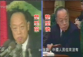 硬漢也愛美 李肇星整牙改形象