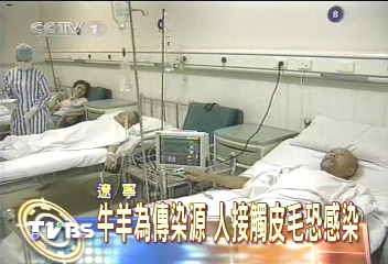 遼寧致命皮膚炭疽病 一人死亡
