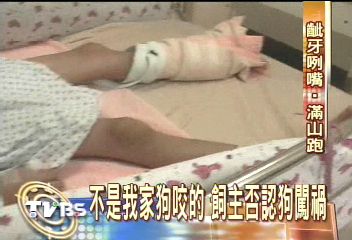不是我家狗咬的　飼主否認狗闖禍