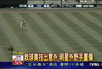 卡麥隆受重傷 顴骨骨折鼻樑斷
