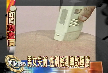 胎兒性別檢測 謀殺女嬰元兇