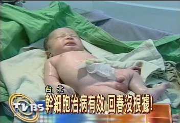 幹細胞治病有效　回春沒根據！