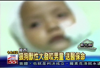 黃土狗咬傷2歲男童　頭部5撕裂傷