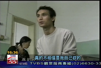 不滿妻子玩過頭　惡夫砍斷右手掌