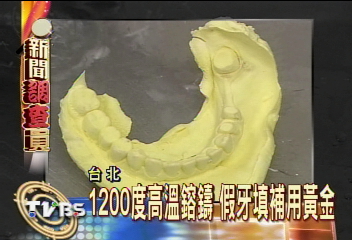 1200度高溫鎔鑄　假牙變黃金