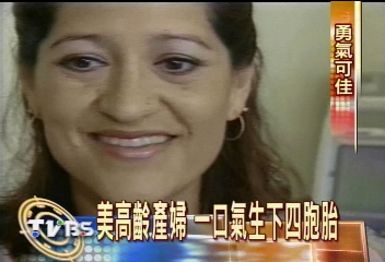 美高齡產婦 一口氣生下四胞胎