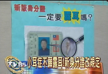 小耳症不願露耳 新身分證改規定