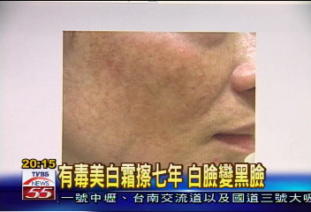 4000元高價美白霜　竟含「汞」