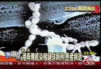 港再傳感染豬鏈球病例 患者病逝