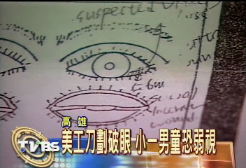 小一生吵架　「小李飛刀」傷同學眼