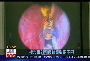 攝護腺肥大 50歲以上男人的痛