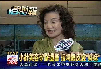 小針美容遺害 拉垮臉皮變「姊妹」