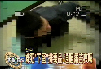 嫌犯「下蛋」排毒品 通腸痛苦哀嚎