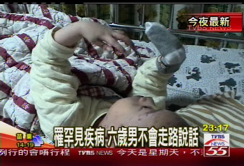罹罕見疾病　6歲男不會走路說話