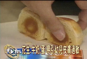 花生、牛奶、蛋　易引幼兒皮膚過敏