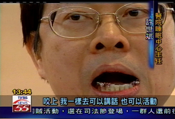 打呼嗎?止鼾牙套幫你脫離惡夢