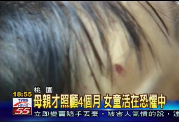 母親的男友下重手　虐待3歲女童