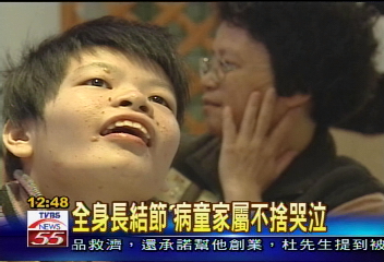 結節罕病無藥醫 家屬心疼哽咽