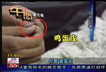 垃圾棉花製黑心棉襖 皮膚病上身