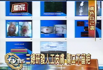 〈獨家〉三總研發「人工皮膚」 老鼠換皮成功