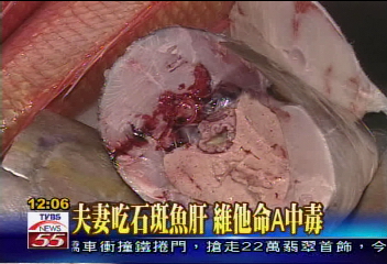 夫妻吃石斑魚肝 維他命A中毒
