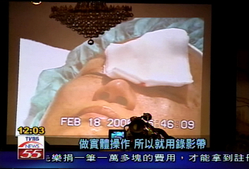 抗老研討會涉密醫?衛局將再查