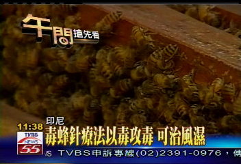 毒蜂針療法以毒攻毒　傳可治風濕