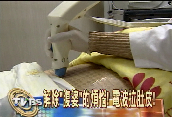 解除「腹婆」的煩惱　電波拉肚皮！
