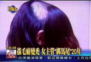 〈獨家〉拔毛癖變禿　女主管「綁馬尾」20年