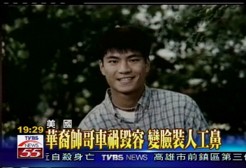 華裔帥哥車禍毀容 變臉裝人工鼻