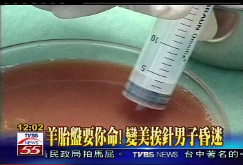 羊胎盤要你命！　變美挨針男子昏迷