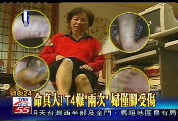 真命大！婦人遭車輾壓　僅受傷腳