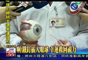 啊！鐵釘插入眼球　幸運救回視力