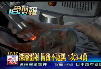 深層雷射除肝斑,70歲阿嬤變阿姨,診所?