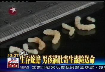 生吞蛇膽 男孩滿肚寄生蟲險送命