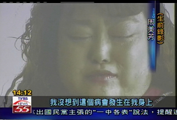 歌手周美芳患魚鱗癬 前年病逝