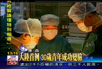 大陸首例　30歲青年成功變臉