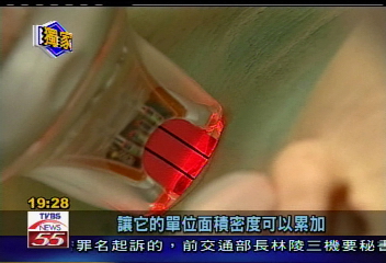 「頸紋」洩漏年齡！　貴婦砸錢雷射