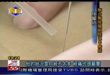 治不孕新招! 中醫師推針灸理論