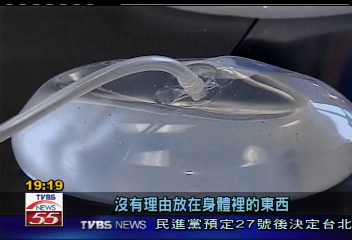 隆乳也有保固期 診所生意暴增