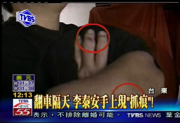 誰在搞軌／翻車後　李泰安兩隻手出現「抓痕」